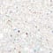 Diamond Plastic Gem Mix by Creatology™