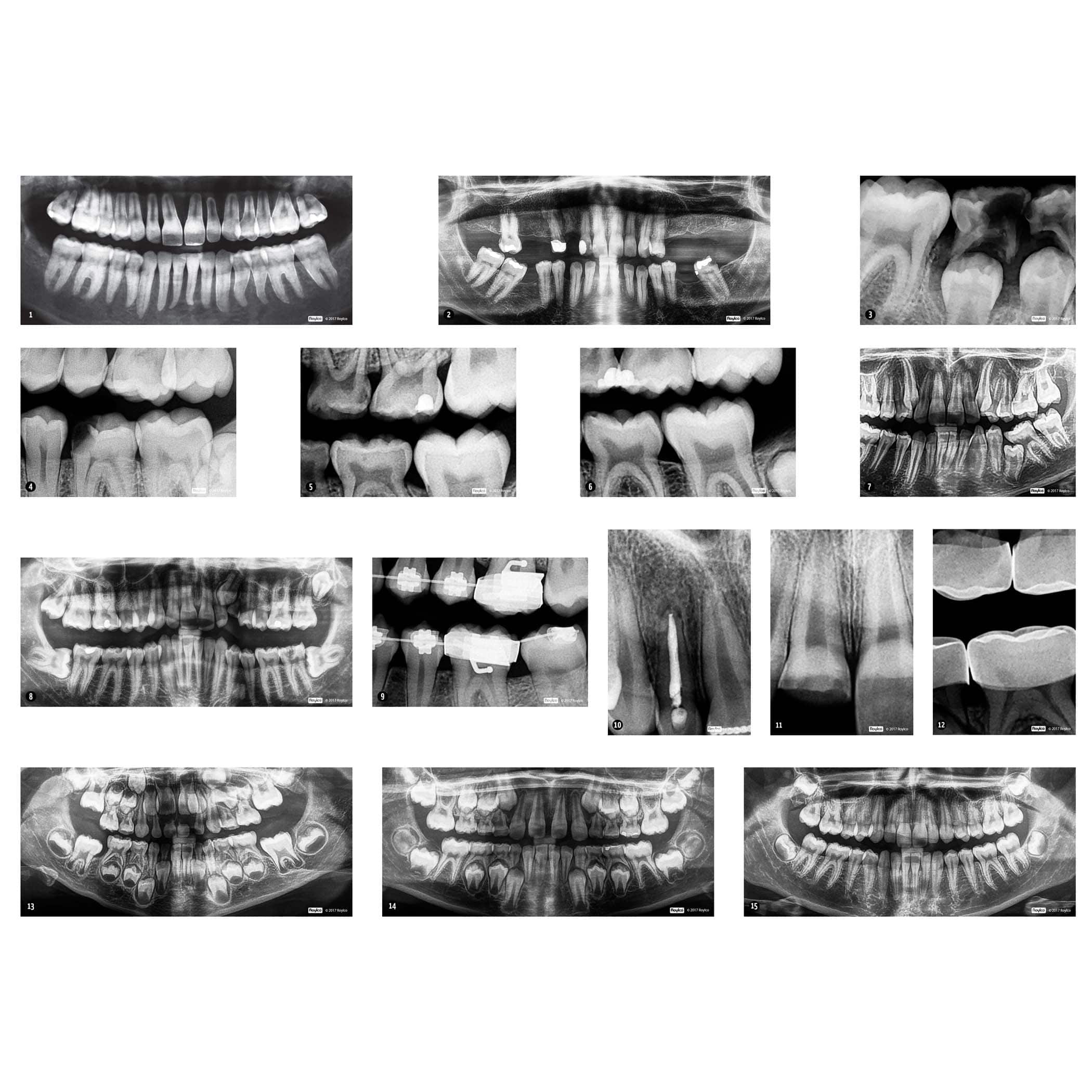 Roylco® Dental X-Rays