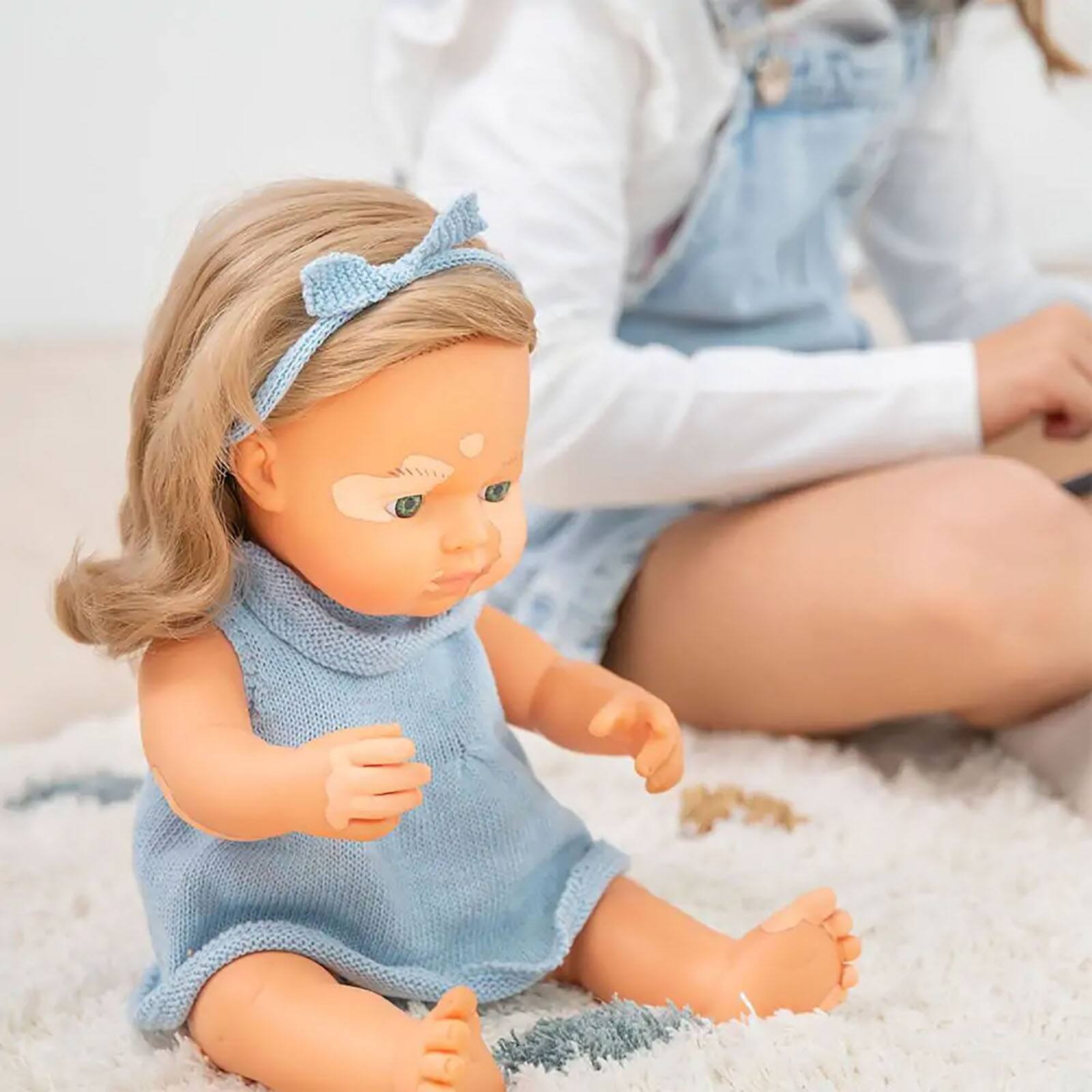 Miniland 15" Anatomically Correct Caucasian Blonde Girl Baby Doll with Vitiligo 